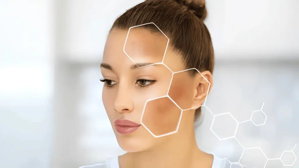 remove-dark-spots-from-face