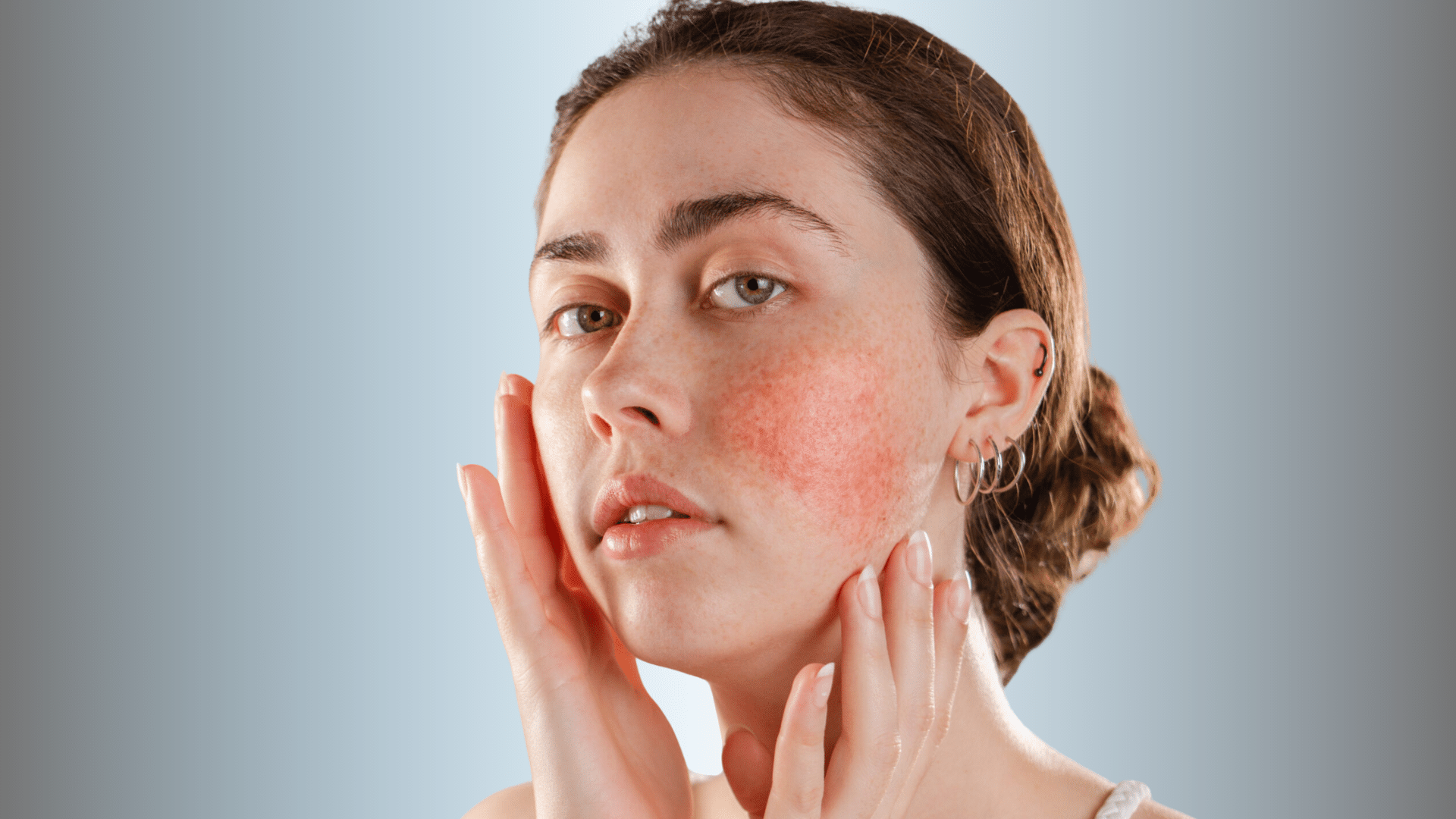 sensitive-skin