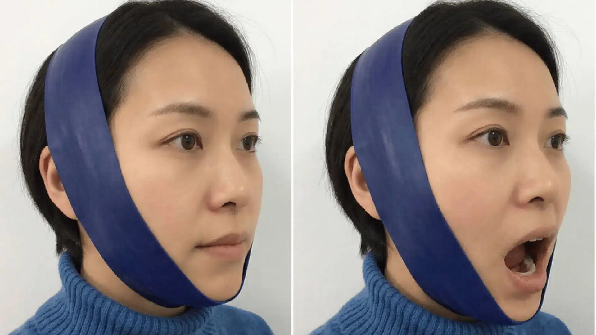 a woman wearing a blue resistance band around her chin, demonstrating a mouth opening exercise for tmj