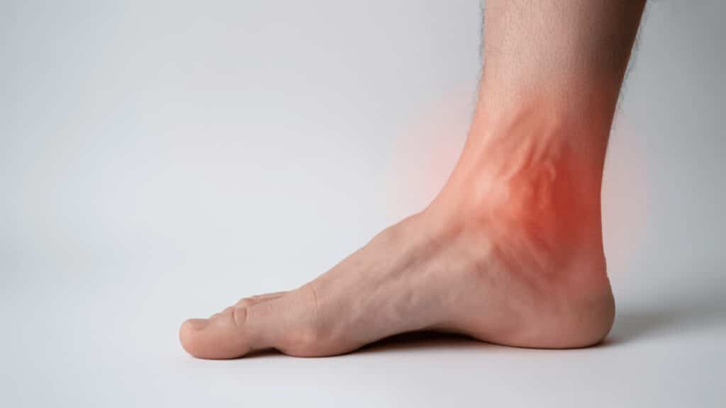 a close-up of a bare foot with redness and swelling around the inner ankle, indicating possible pain or injury