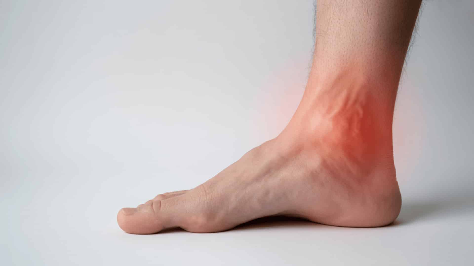 a close-up of a bare foot with redness and swelling around the inner ankle, indicating possible pain or injury